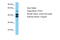 PTOV1 Extended AT-Hook Containing Adaptor Protein antibody, ARP50614_P050, Aviva Systems Biology, Western Blot image 