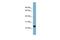 RAB22A, Member RAS Oncogene Family antibody, GTX44911, GeneTex, Western Blot image 