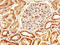 Serpin Family A Member 6 antibody, CSB-PA021062EA01HU, Cusabio, Immunohistochemistry paraffin image 