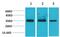Calcium Voltage-Gated Channel Auxiliary Subunit Gamma 4 antibody, A10824, Boster Biological Technology, Western Blot image 