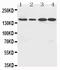 Rho Associated Coiled-Coil Containing Protein Kinase 2 antibody, PA1242, Boster Biological Technology, Western Blot image 