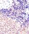 Polycomb protein SUZ12 antibody, PA5-72232, Invitrogen Antibodies, Immunohistochemistry paraffin image 