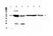 Glycerol Kinase antibody, A02884-1, Boster Biological Technology, Western Blot image 