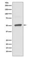 Bactericidal Permeability Increasing Protein antibody, M01444, Boster Biological Technology, Western Blot image 