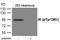 Insulin Receptor antibody, GTX55415, GeneTex, Western Blot image 