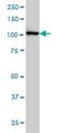 Cbl Proto-Oncogene antibody, H00000867-M01, Novus Biologicals, Western Blot image 