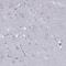 Cholinergic Receptor Nicotinic Alpha 1 Subunit antibody, NBP2-57262, Novus Biologicals, Immunohistochemistry paraffin image 