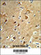 Protein Phosphatase, Mg2+/Mn2+ Dependent 1H antibody, 63-778, ProSci, Immunohistochemistry paraffin image 