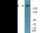 TSC Complex Subunit 2 antibody, EKC2131, Boster Biological Technology, Western Blot image 