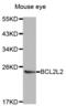 BCL2L2-PABPN1 Readthrough antibody, abx001072, Abbexa, Western Blot image 