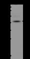 Metallophosphoesterase 1 antibody, 204660-T40, Sino Biological, Western Blot image 