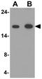 Microtubule Associated Protein 1 Light Chain 3 Alpha antibody, GTX31934, GeneTex, Western Blot image 