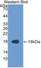 Supervillin antibody, LS-C314287, Lifespan Biosciences, Western Blot image 