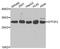 General Transcription Factor IIF Subunit 2 antibody, A10896, Boster Biological Technology, Western Blot image 