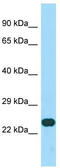 Coiled-Coil Domain Containing 59 antibody, TA331982, Origene, Western Blot image 