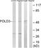 DNA Polymerase Delta 3, Accessory Subunit antibody, A30646, Boster Biological Technology, Western Blot image 