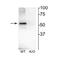 Cholinergic Receptor Nicotinic Beta 4 Subunit antibody, NBP2-60788, Novus Biologicals, Western Blot image 