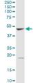 GDP-Mannose 4,6-Dehydratase antibody, H00002762-D02P, Novus Biologicals, Western Blot image 