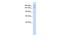 Intraflagellar Transport 140 antibody, A07384, Boster Biological Technology, Western Blot image 