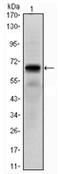 Parathyroid Hormone 1 Receptor antibody, AM06494SU-N, Origene, Western Blot image 
